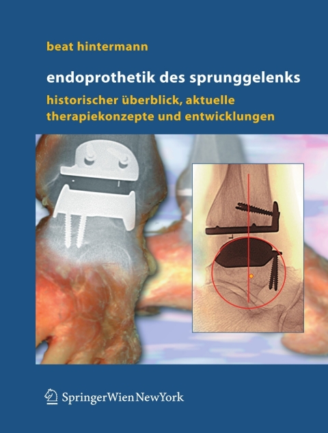 Cover image for book Endoprothetik des Sprunggelenks