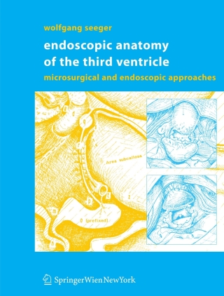 Endoscopic Anatomy of the Third Ventricle