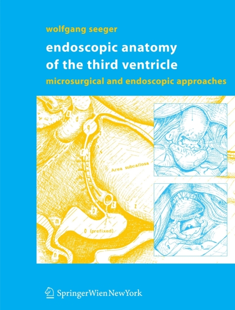 Cover image for book Endoscopic Anatomy of the Third Ventricle