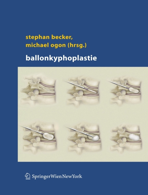Ballonkyphoplastie 