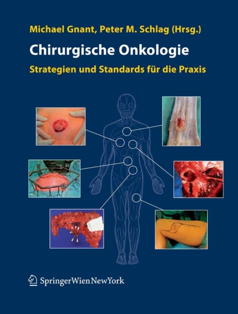 Cover image for book Chirurgische Onkologie
