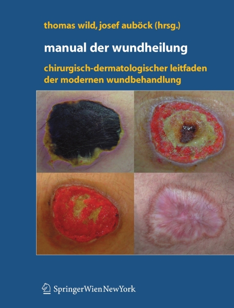 Cover image for book Manual der Wundheilung