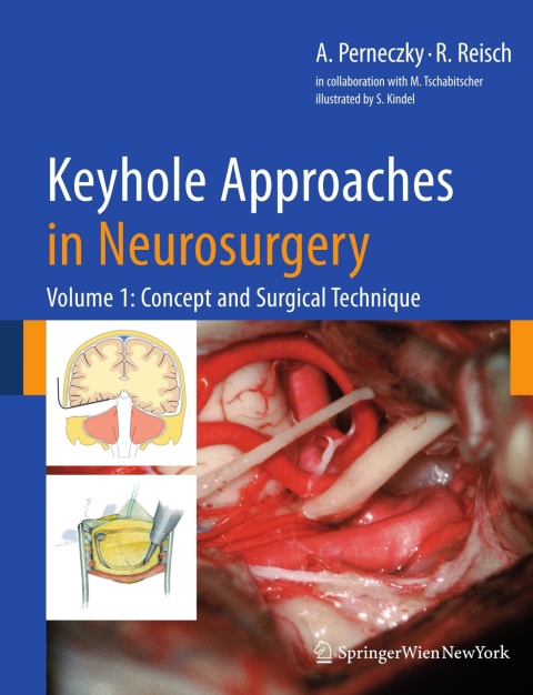 Cover image for book Keyhole Approaches in Neurosurgery