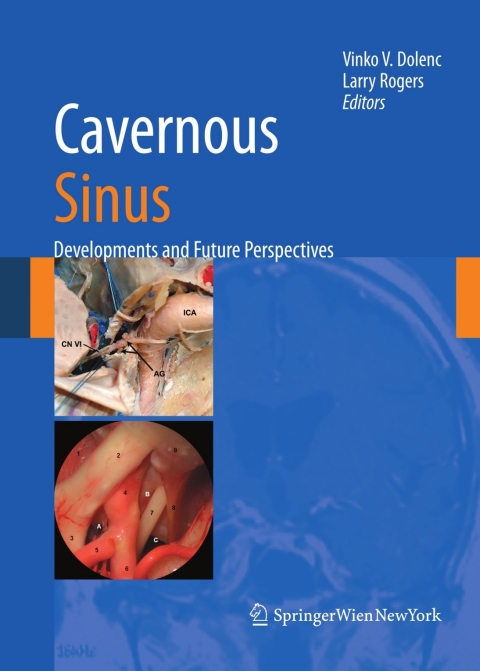 Cover image for book Cavernous Sinus