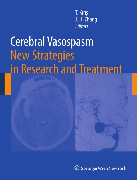 Cover image for book Cerebral Vasospasm