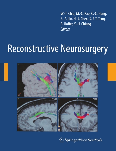 Cover image for book Reconstructive Neurosurgery