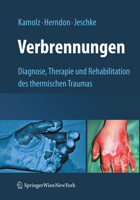 Cover image for book Verbrennungen