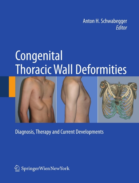 Cover image for book Congenital Thoracic Wall Deformities