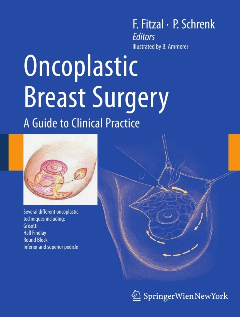 Cover image for book Oncoplastic Breast Surgery