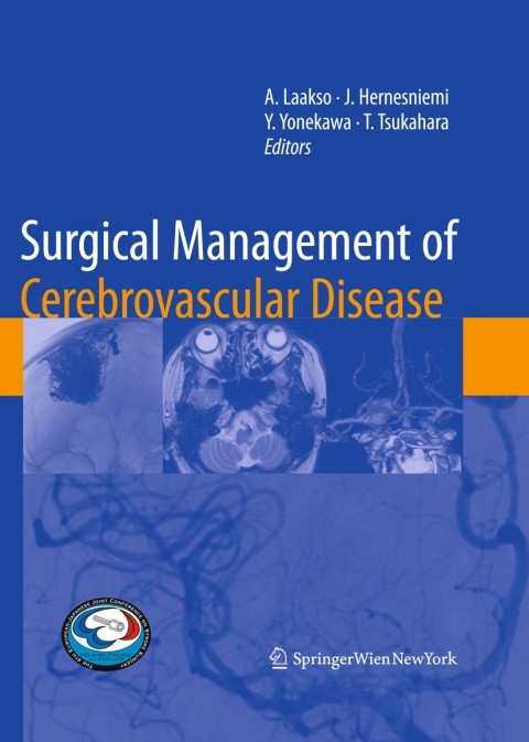 Cover image for book Surgical Management of Cerebrovascular Disease