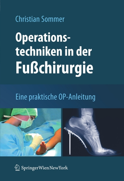 Cover image for book Operationstechniken in der Fußchirurgie