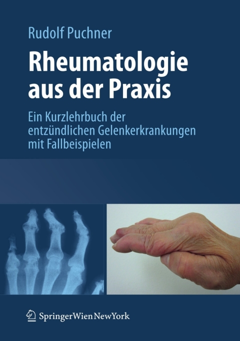 Cover image for book Rheumatologie aus der Praxis
