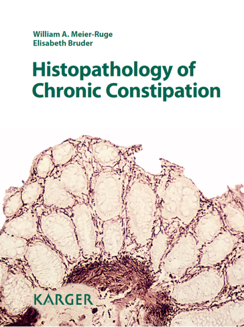 Cover image for book Histopathology of Chronic Constipation
