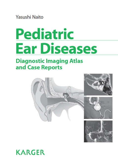 Cover image for book Pediatric Ear Diseases