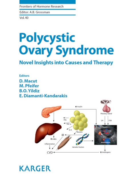 Cover image for book Polycystic Ovary Syndrome