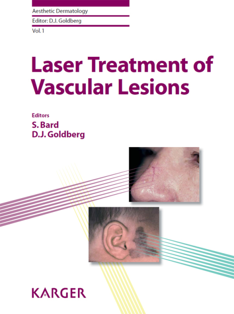 Cover image for book Laser Treatment of Vascular Lesions