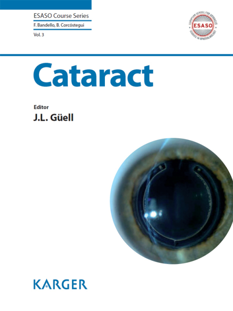 Cover image for book Cataract