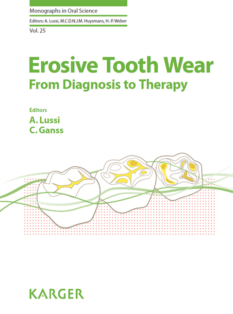 Cover image for book Erosive Tooth Wear