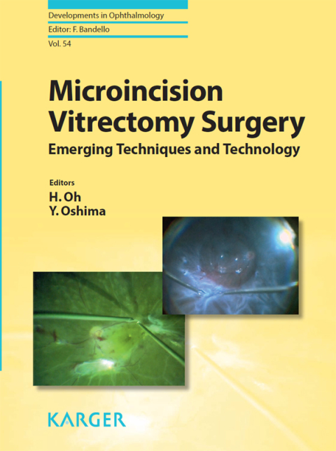 Cover image for book Microincision Vitrectomy Surgery