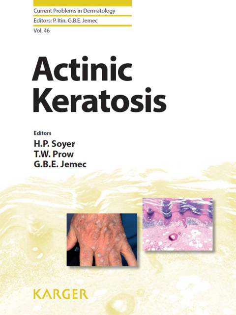 Cover image for book Actinic Keratosis
