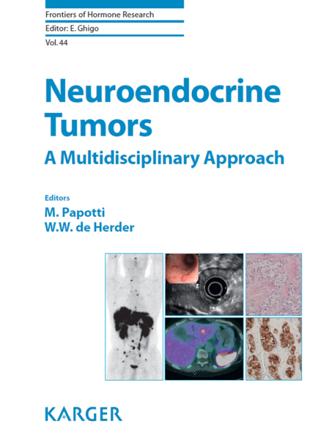 Cover image for book Neuroendocrine Tumors: A Multidisciplinary Approach