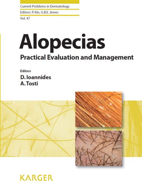 Cover image for book Alopecias - Practical Evaluation and Management