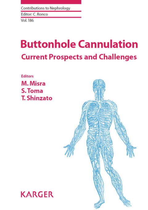 Cover image for book Buttonhole Cannulation