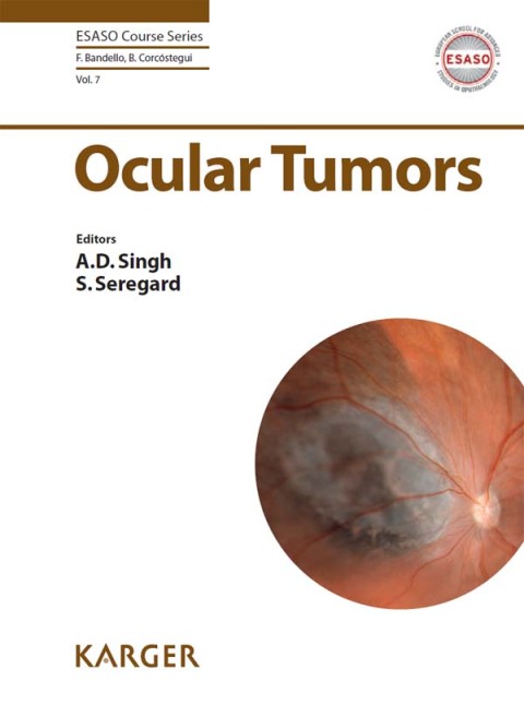 Cover image for book Ocular Tumors