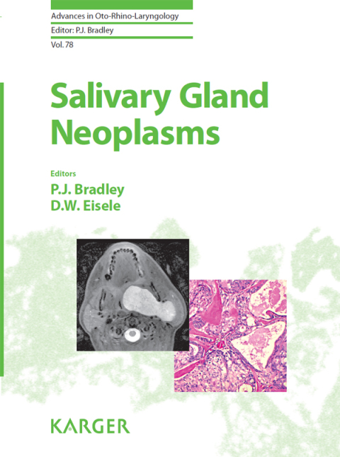 Cover image for book Salivary Gland Neoplasms
