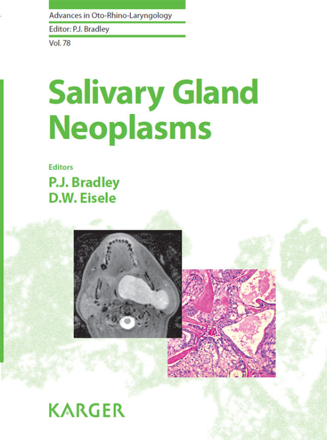 Salivary Gland Neoplasms