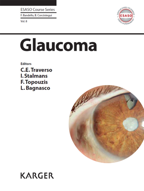 Cover image for book Glaucoma