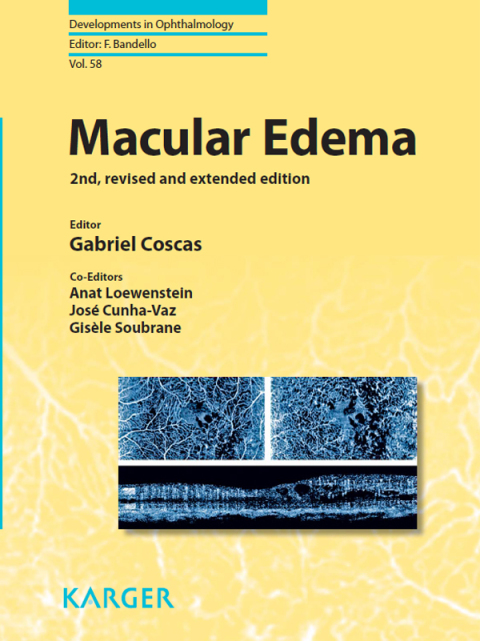 Cover image for book Macular Edema