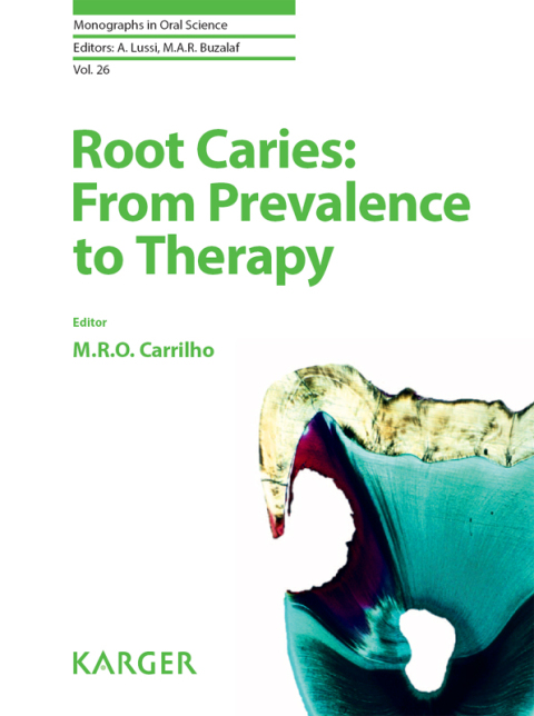 Cover image for book Root Caries: From Prevalence to Therapy