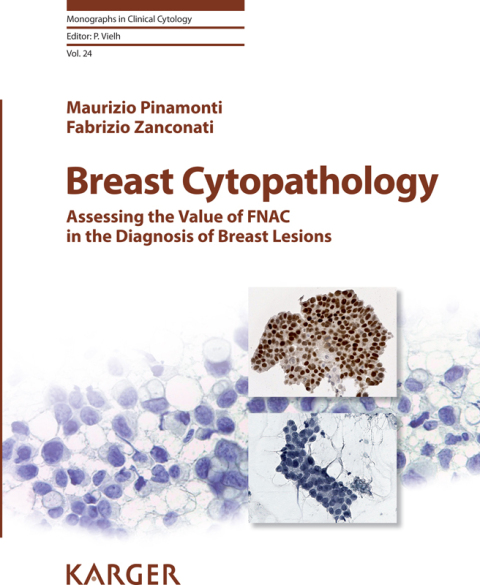 Breast Cytopathology 