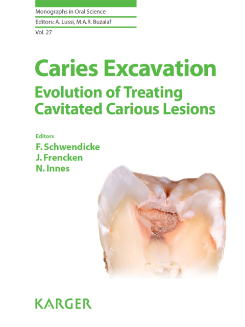 Cover image for book Caries Excavation: Evolution of Treating Cavitated Carious Lesions