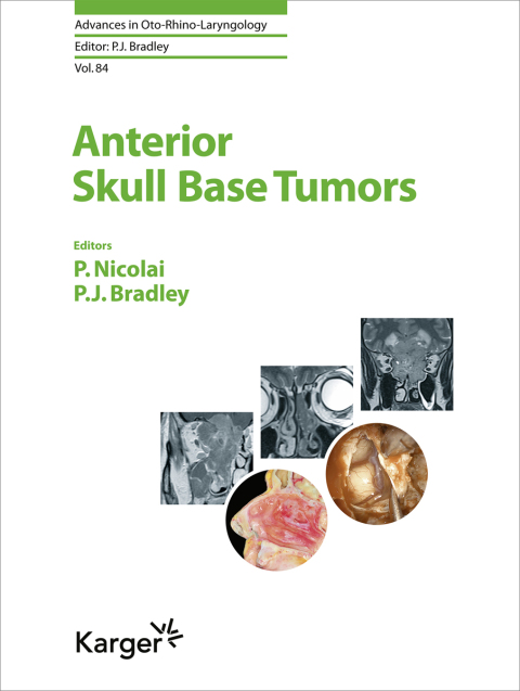 Cover image for book Anterior Skull Base Tumors