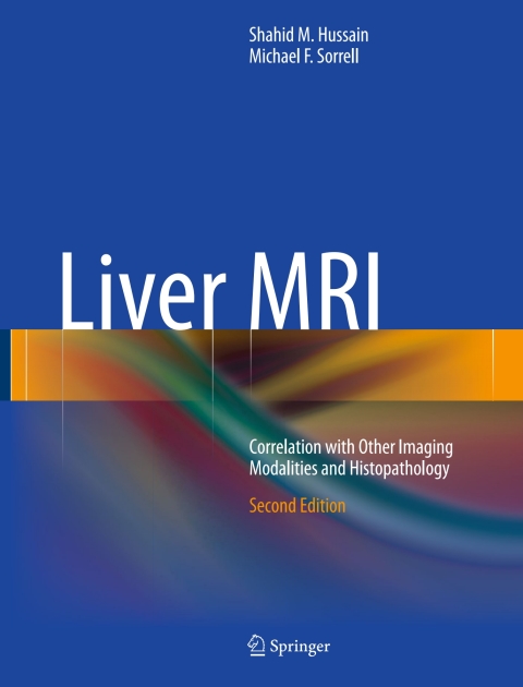 Cover image for book Liver MRI