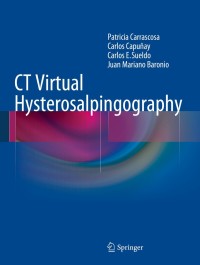 Cover image: CT Virtual Hysterosalpingography 9783319075594