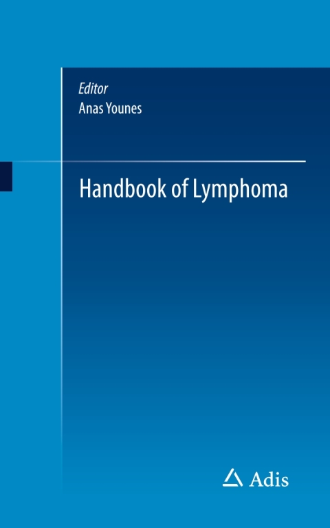 Cover image for book Handbook of Lymphoma