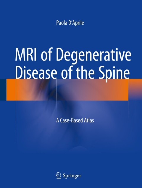 Cover image for book MRI of Degenerative Disease of the Spine