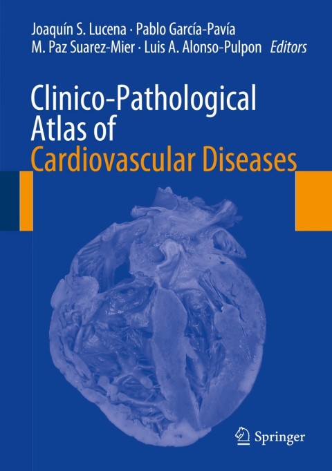 Cover image for book Clinico-Pathological Atlas of Cardiovascular Diseases
