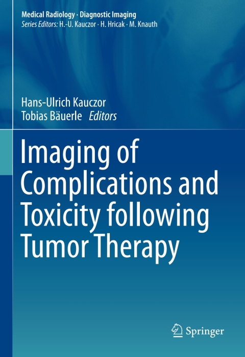 Cover image for book Imaging of Complications and Toxicity following Tumor Therapy