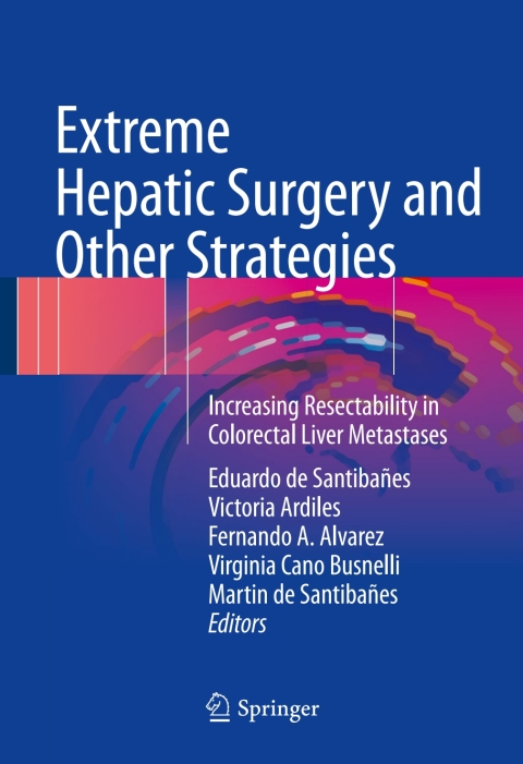 Cover image for book Extreme Hepatic Surgery and Other Strategies