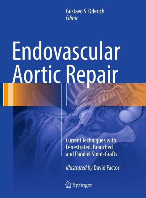 Cover image for book Endovascular Aortic Repair