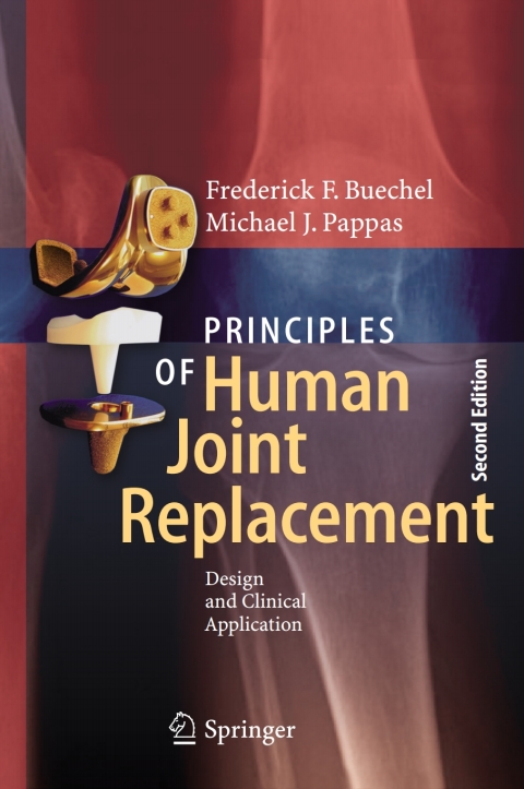 Cover image for book Principles of Human Joint Replacement