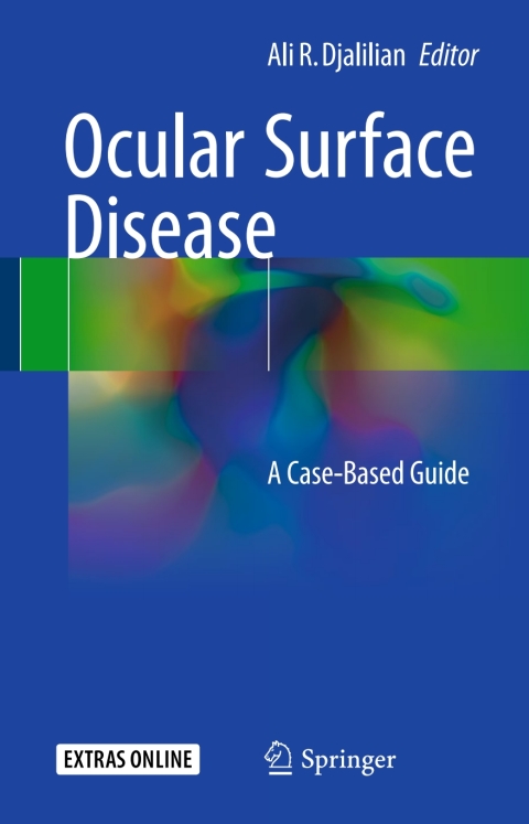Cover image for book Ocular Surface Disease