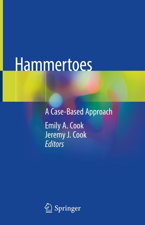 Cover image for book Hammertoes