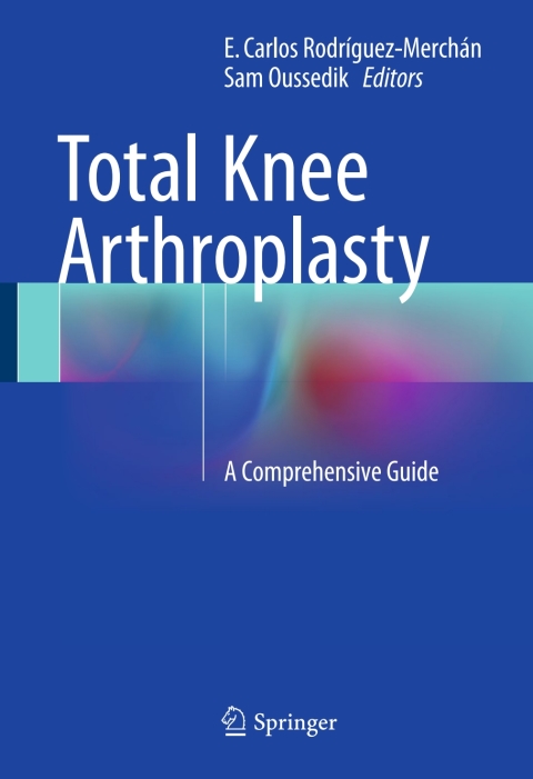 Cover image for book Total Knee Arthroplasty