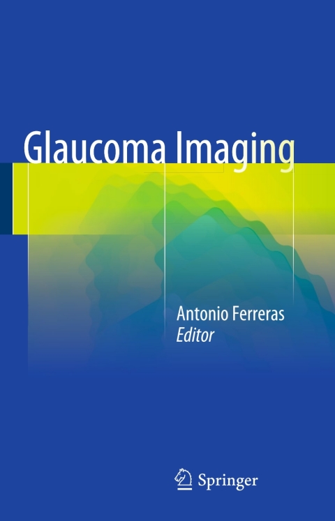 Cover image for book Glaucoma Imaging