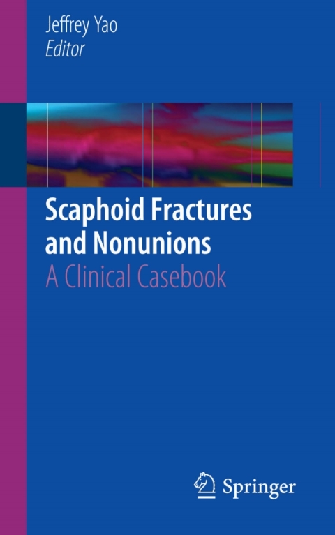 Cover image for book Scaphoid Fractures and Nonunions